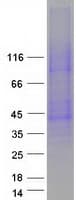 Human SLC10A1 / NTCP Protein (Recombinant Myc-DDK (Flag))