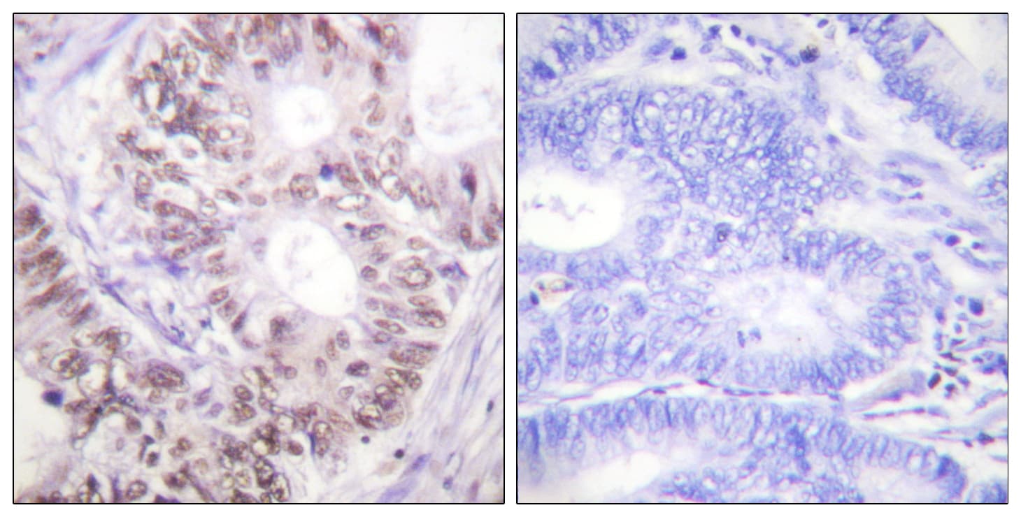 Polyclonal Rabbit anti-Human CDC25C Antibody (phospho-Thr48, IHC, WB)