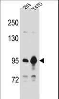 CTNNB1 / Beta Catenin Antibody (aa692-721)