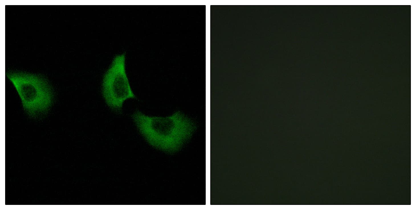IHC-plus™ FBLN4 / EFEMP2 Antibody (aa91-140)
