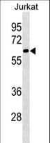 SLU7 / 9G8 Antibody (aa60-86)