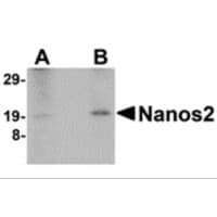 NANOS2 / NOS2 Antibody