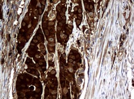 NME1 / NM23 Antibody (clone OTI7D6)