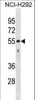 HNRNPH1 / hnRNP H Antibody (aa48-77)