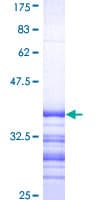 Human WC1 / ATP7B Protein (Recombinant GST, N-terminus)