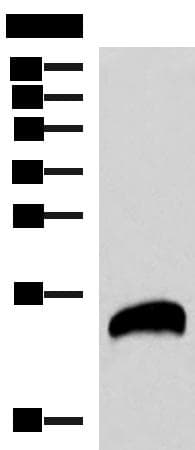REG1B Antibody