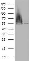 Monoclonal Mouse anti-Human FEN1 Antibody (clone OTI3A8, aa117-380, IHC, WB)