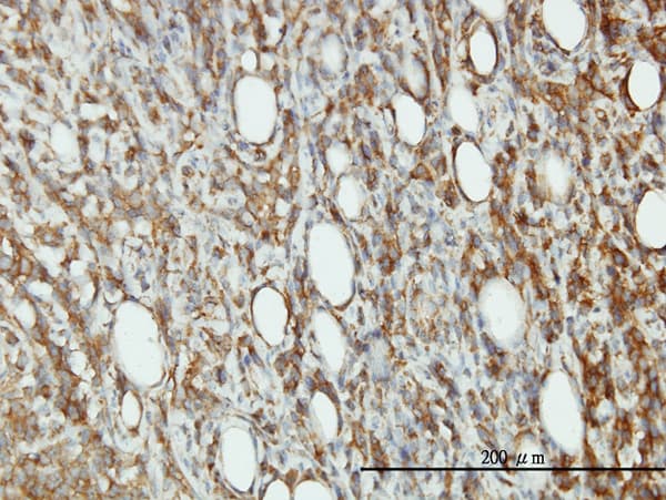 Monoclonal Mouse anti-Human EIF5 Antibody (clone 2E6-4C12, IHC, IF, WB)