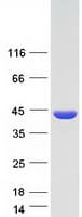 Human DMC1 Protein (Recombinant Myc-DDK (Flag))