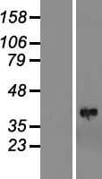 LIMS1 / PINCH Protein (Over-Expression Lysate Myc-DDK (Flag))