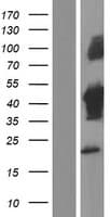 Human TUFT1 Protein (Over-Expression Lysate Myc-DDK (Flag))