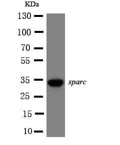 Polyclonal Rabbit anti-Human Osteonectin / SPARC Antibody (aa284-303, IHC, WB)