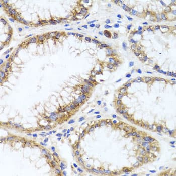 GPM6A / Glycoprotein M6A Antibody