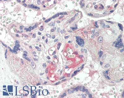 IHC-plus™ Polyclonal Rabbit anti-Human CRHBP Antibody (IHC, IF, WB)