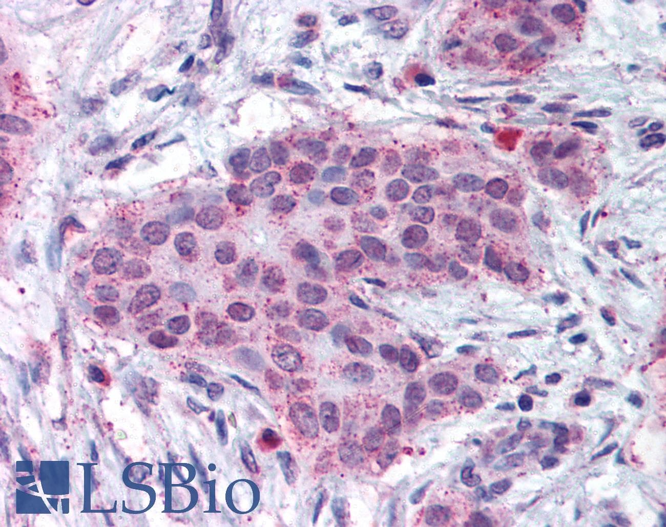 IHC-plus™ MMP13 Antibody (N-Terminus)