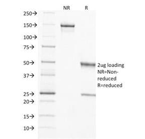TIMP2 Antibody (clone 3A4, Azide-free, BSA-free)