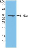 ROCK2 Antibody (aa904-1140)