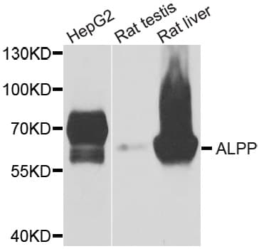 PLAP / Alkaline Phosphatase Antibody