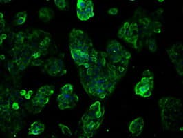 KIAA0153 / TTLL12 Antibody (clone OTI7F11)