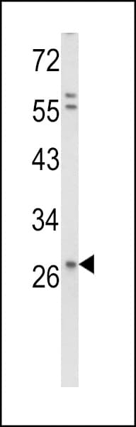Polyclonal Rabbit anti-Human SDC1 / Syndecan 1 / CD138 Antibody (aa266-295, WB)