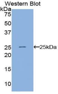 ANGPTL8 / Betatrophin Antibody (aa24-196, FITC)