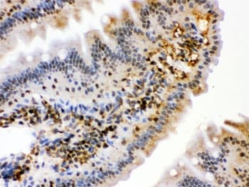 HSPA2 Antibody