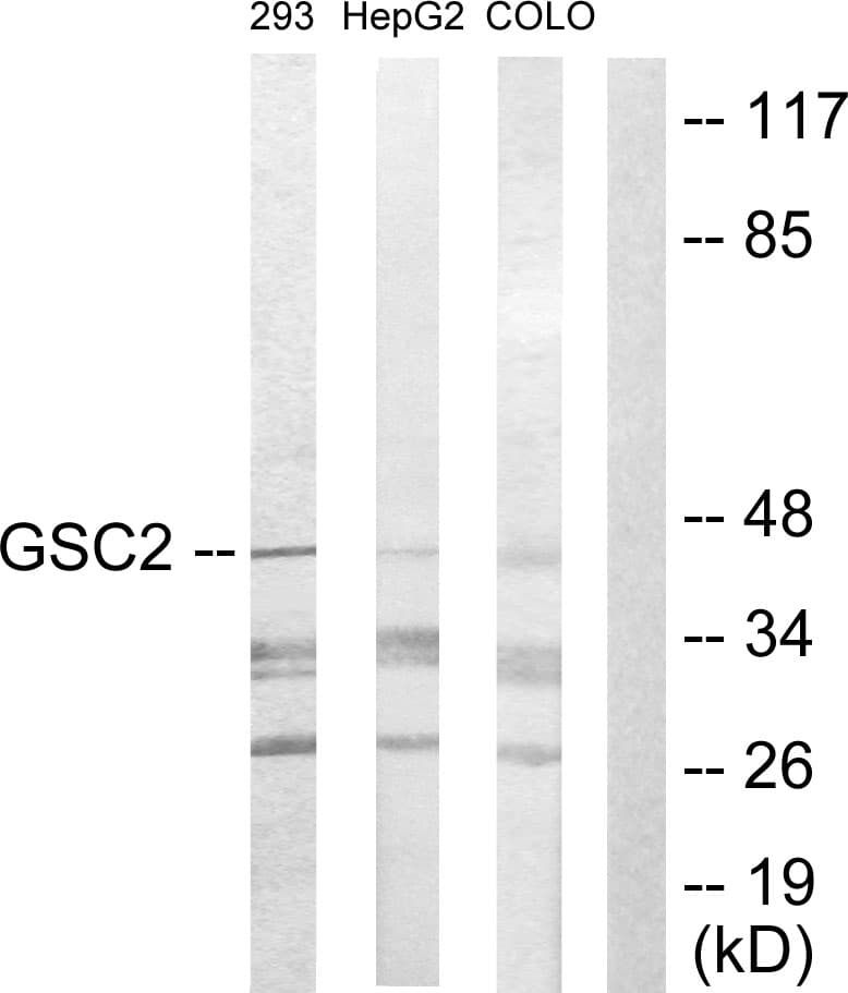 GSCL / GSC2 Antibody (aa131-180)