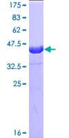 Human BIRC5 / Survivin Protein (Recombinant GST)