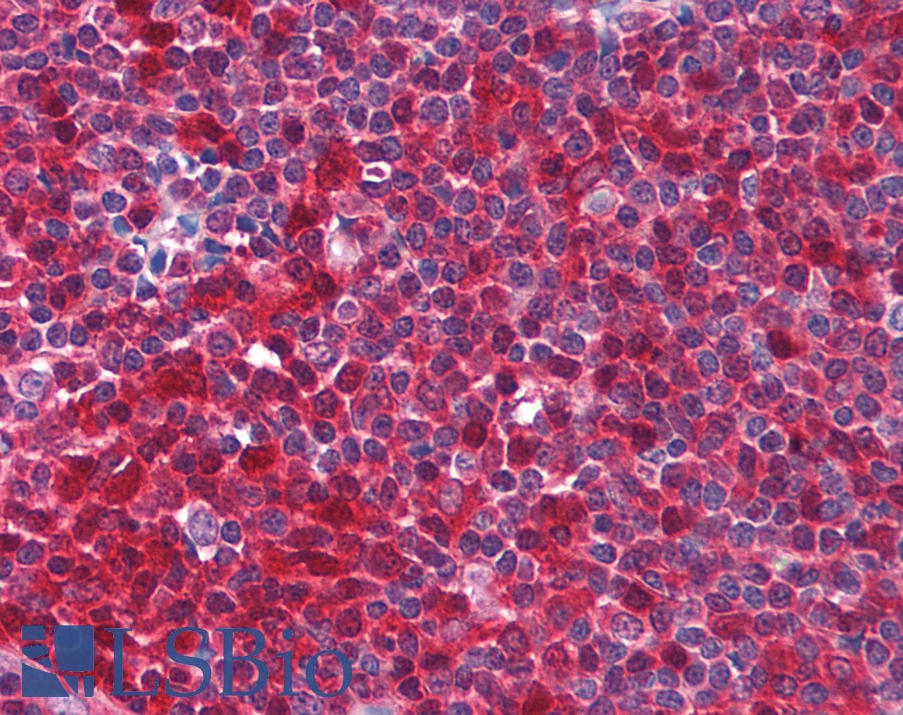 IHC-plus™ PYCARD / ASC / TMS1 Antibody