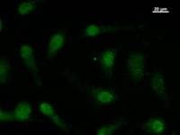 FBXO18 / FBH1 Antibody (clone 2353C1a)