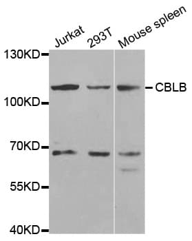 Polyclonal Rabbit anti-Human CBLB Antibody (IHC, WB)