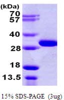 Human OTUB2 Protein (Recombinant His)