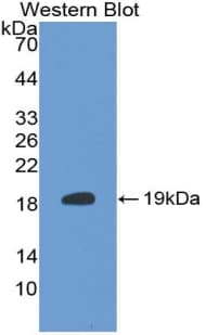 S100A6 / Calcyclin Antibody (aa1-89)