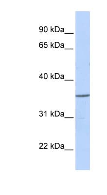Polyclonal Rabbit anti-Human ZNF688 Antibody (aa108-157, WB)
