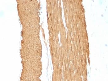 ACTA2 / Smooth Muscle Actin Antibody (N-Terminus, clone 1A4 + ACTA2/791)
