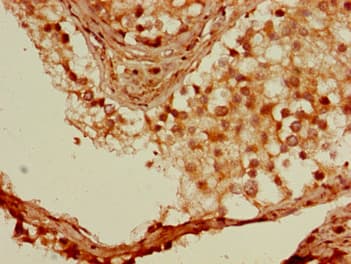 SSX1 Antibody