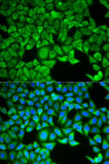 Polyclonal Rabbit anti-Human SLC3A1 / ATR1 Antibody (IHC, IF, WB)