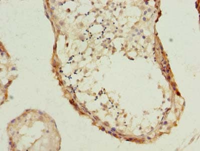 PHF10 Antibody