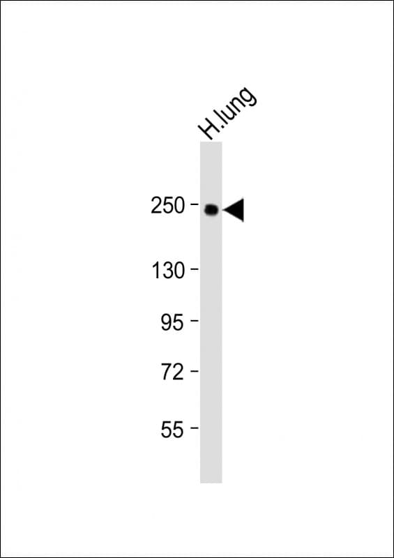 COL14A1 / Collagen XIV Antibody (Internal)