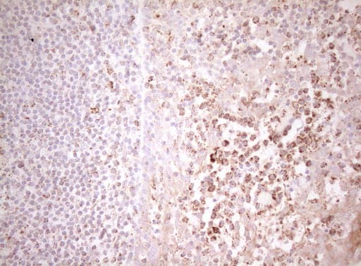 DECR1 Antibody (clone OTI5D12, Carrier-free)