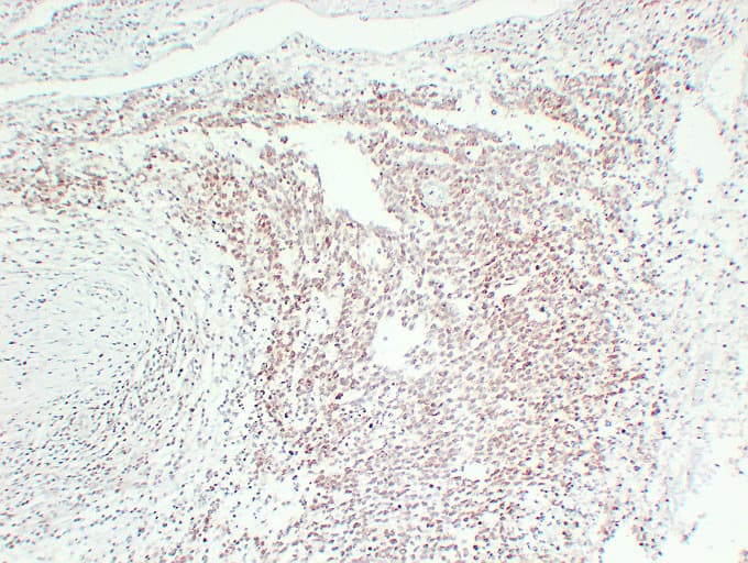 Monoclonal Mouse anti-Human FLI1 Antibody (clone ABT-FLI1, IHC, WB)