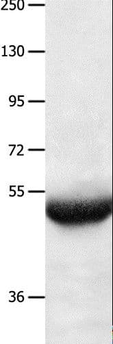 BPIFB3 / C20orf185 Antibody