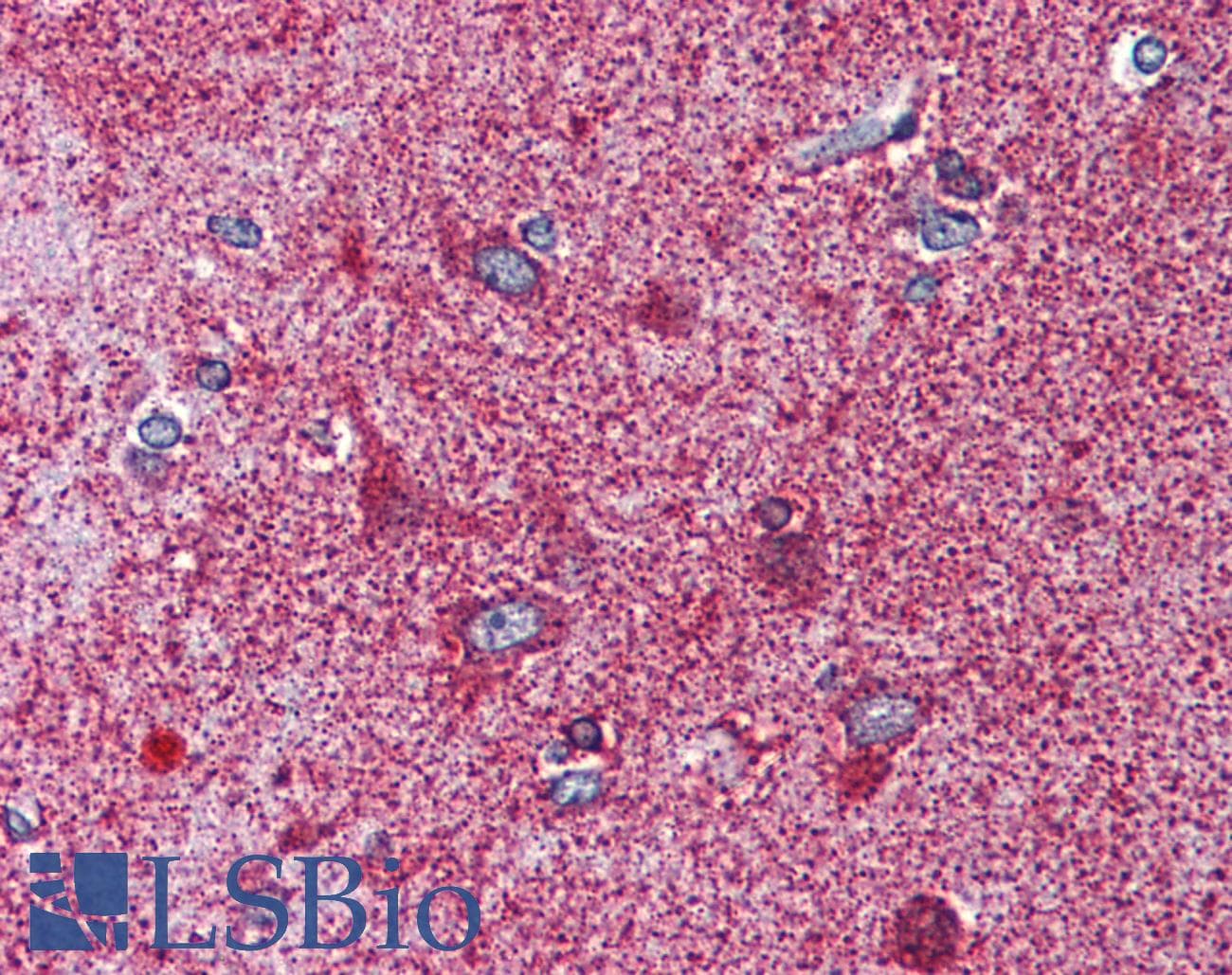 IHC-plus™ MC3R / MC3 Receptor Antibody (C-Terminus)