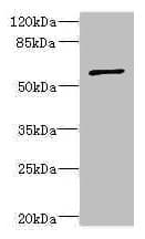 Polyclonal Rabbit anti-Human TCBE / KCS / HRD Antibody (IHC, WB)