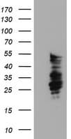 SERPINB2 / PAI-2 Antibody (clone 1F6, Carrier-free)