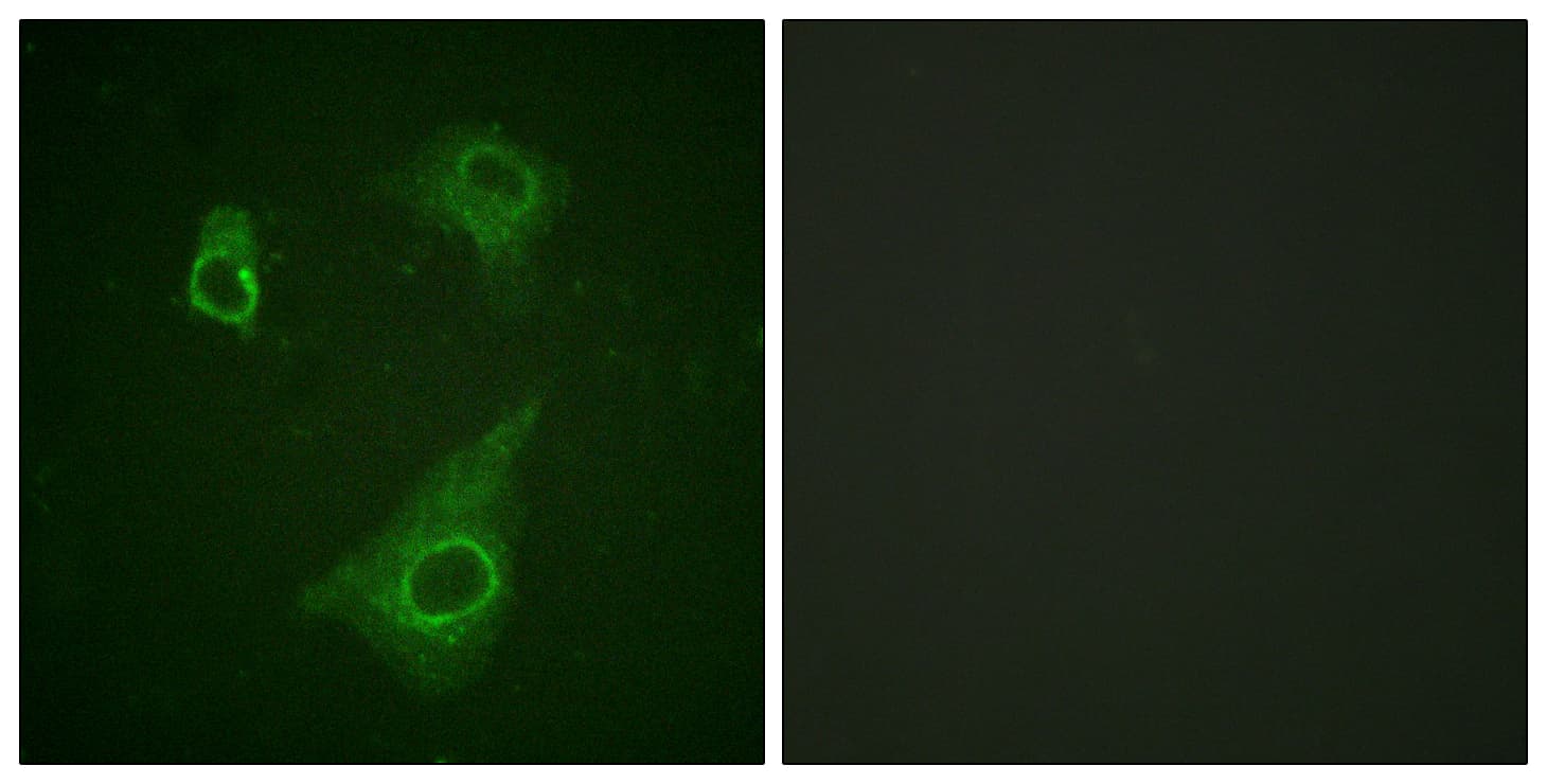 EPOR / EPO Receptor Antibody (phospho-Tyr368)
