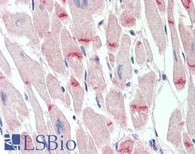Polyclonal Rabbit anti-Human DSG2 / Desmoglein 2 Antibody (aa275-533, IHC, WB)
