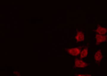 Polyclonal Rabbit anti-Human RNF14 / ARA54 Antibody (IF, WB)