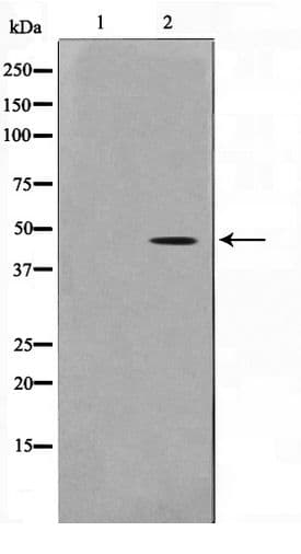 Polyclonal Rabbit anti-Human Actin Antibody (IHC, WB)