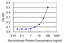 IHC-plus™ VCP Antibody (clone 4A8)